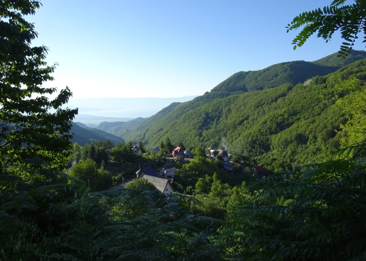 All-on-4 with Fixed Zirconia Teeth - Mountain Trip Gorna Belica