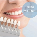  Professional Teeth Whitening by Licensed Dentist in North Macedonia